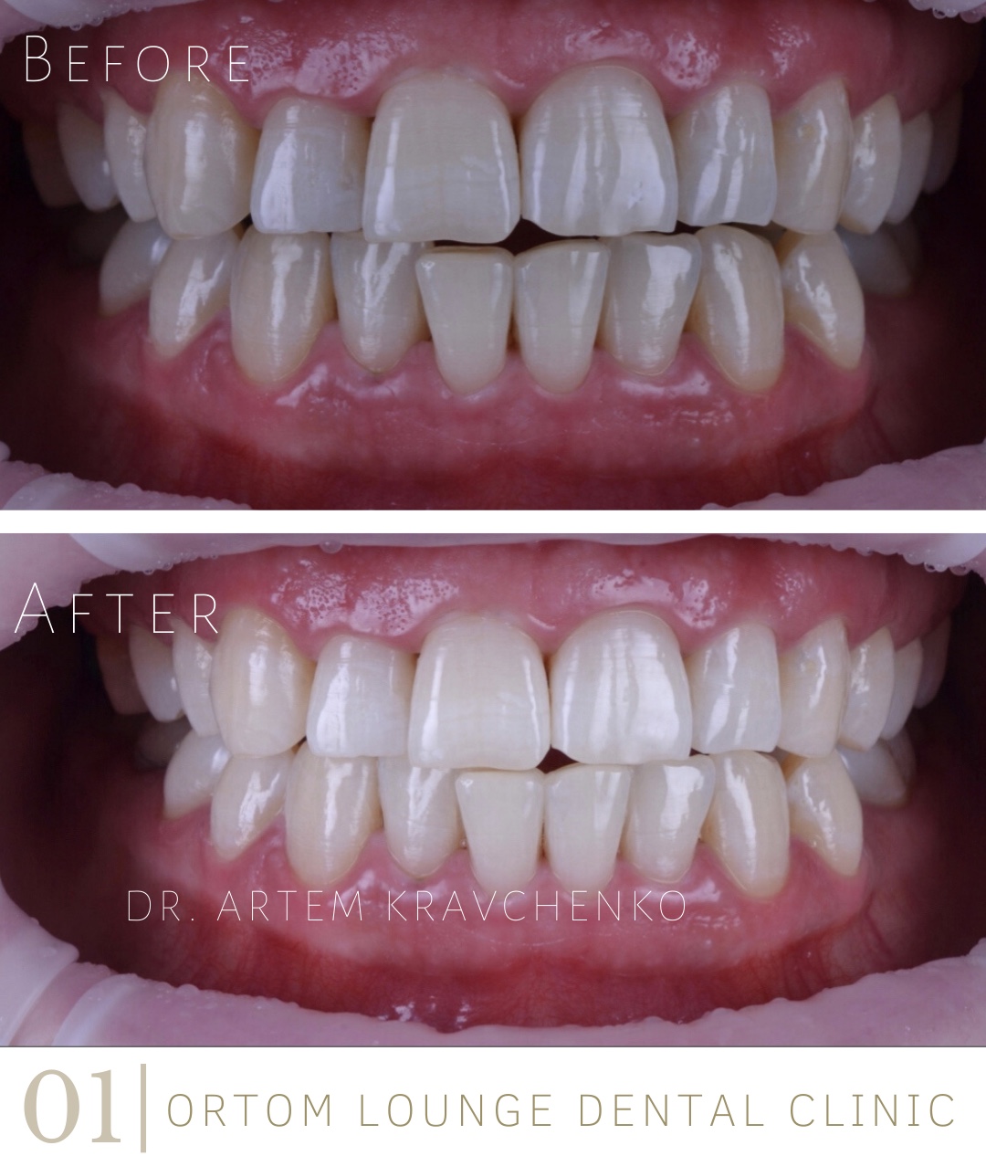 B8561928-4F4C-449B-AC92-081E6F6FB085