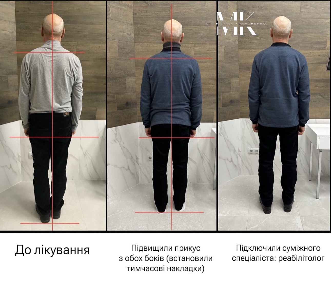 Остеопатична стоматологія Остеопатична стоматологія